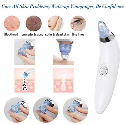 Multi-function Blackhead & Whitehead  Remover | Electric Derma suction Machine