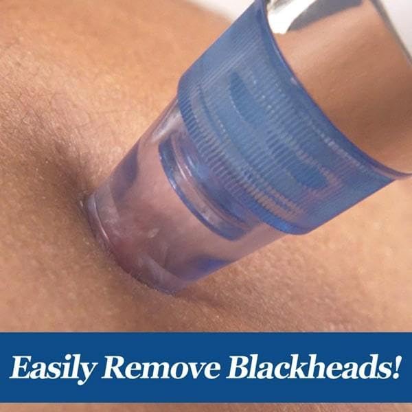 Multi-function Blackhead & Whitehead  Remover | Electric Derma suction Machine